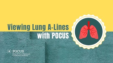 Viewing Lung A Lines with POCUS