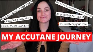 MY ACCUTANE STORY!! SIT DOWN &amp; VLOG! MY FIRST MONTH!