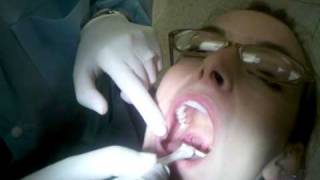 Extra and Intra Oral Examination