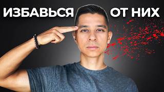 видео: 5 ТОКСИЧНЫХ ПРИВЫЧЕК, которые медленно и незаметно РАЗРУШАЮТ нашу ЖИЗНЬ картинка: 5 ТОКСИЧНЫХ ПРИВЫЧЕК, которые медленно и незаметно РАЗРУШАЮТ нашу ЖИЗНЬ