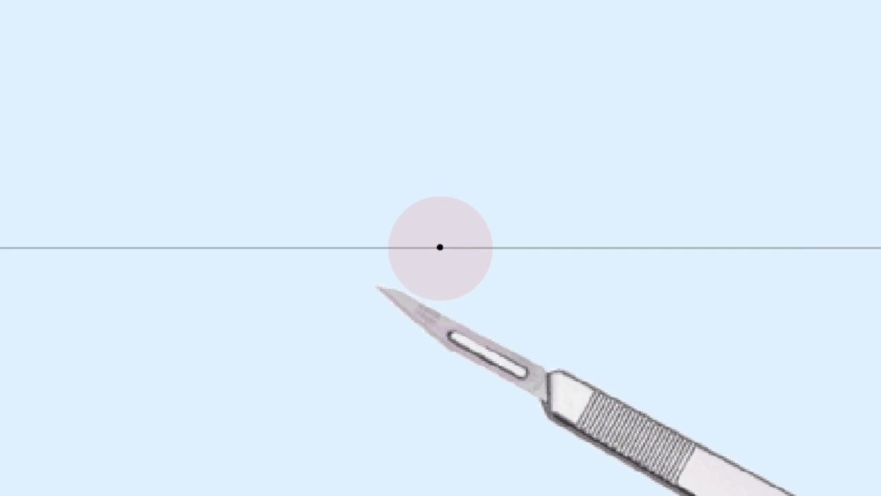 Psychoacoustic Auditory Display for Surgeons (VI)
