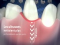 Brosse  dents  ultrasons  emmident professional fr