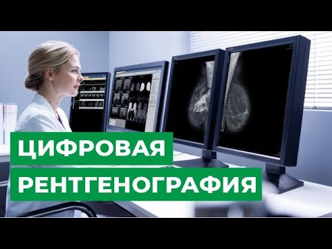 Цифровая рентгенография