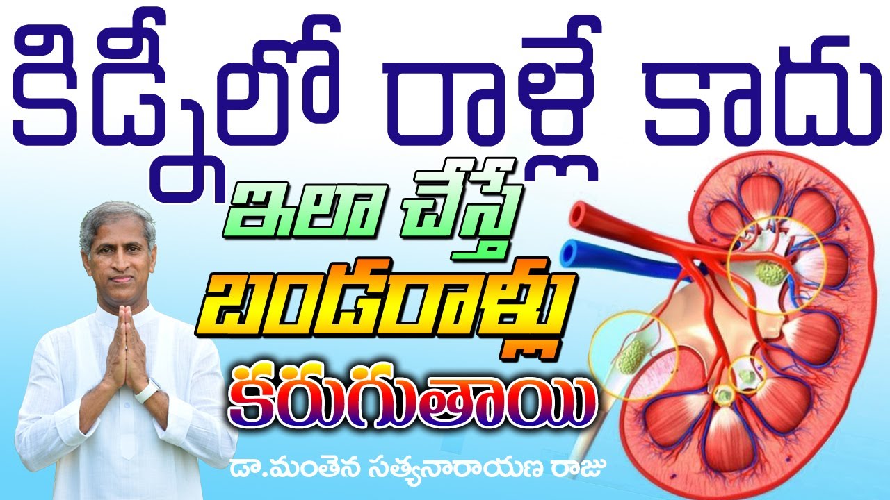 Kidney Stones Causes and Treatment Explained By Dr Manthena Satyanarayana Raju Videso | GOOD HEALTH