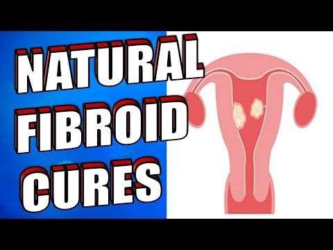 20-natural-ways-to-treat-&-shrink-fibroids-easily-|-natural-cures-for-fibroids