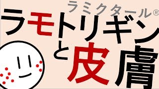 ラモトリギンと皮膚障害［本格］気分障害、双極性障害　精神科・精神医学のWeb講義