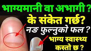 नङ मा अर्ध चन्द्र छ? के संकेत गर्छ ? भाग्य र स्वास्थ्य | health tips | Health om tv nepal