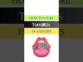 How to cure Tonsillitis in 4 hours | Treatment of Tonsillitis at home #benefitology #ytshorts #heal