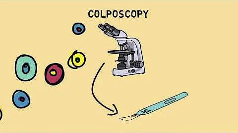 The most common STI in the world: HPV