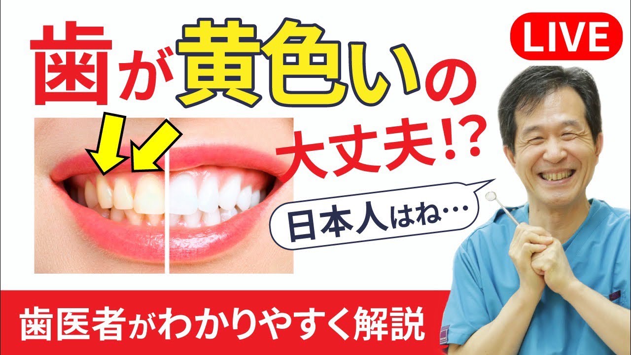 歯の色が黄色いのですが大丈夫！？ 】歯医者がわかりやすく解説します