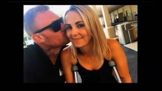 Clip 399 Story to my broken ankle slc