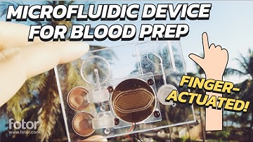 Microfluidic finger-actuated blood lysate preparation device enabled by rapid acoustofluidic mixing