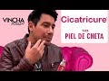 Cicatricure para piel de CHETA