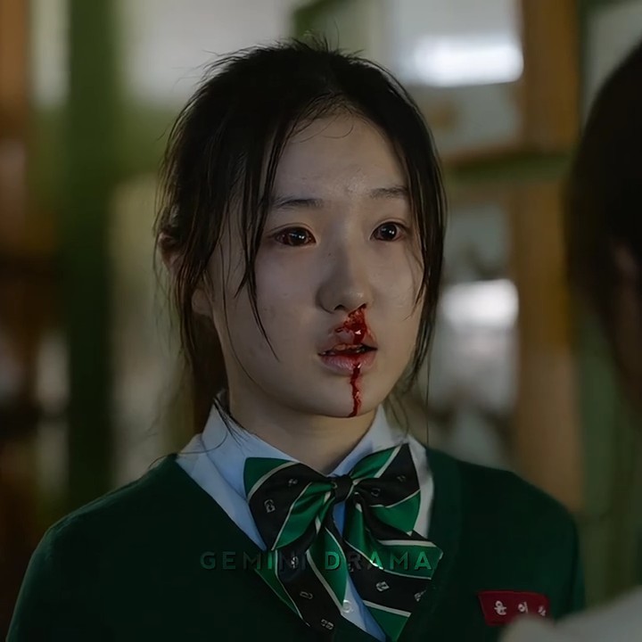Park ji-hu best friend is changing zombie😭💔sad moments #koreandrama#allofusaredead#shorts