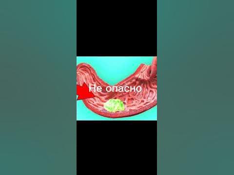 опасно ли жвачка? что будет если проглотить жвачку? факт - YouTube