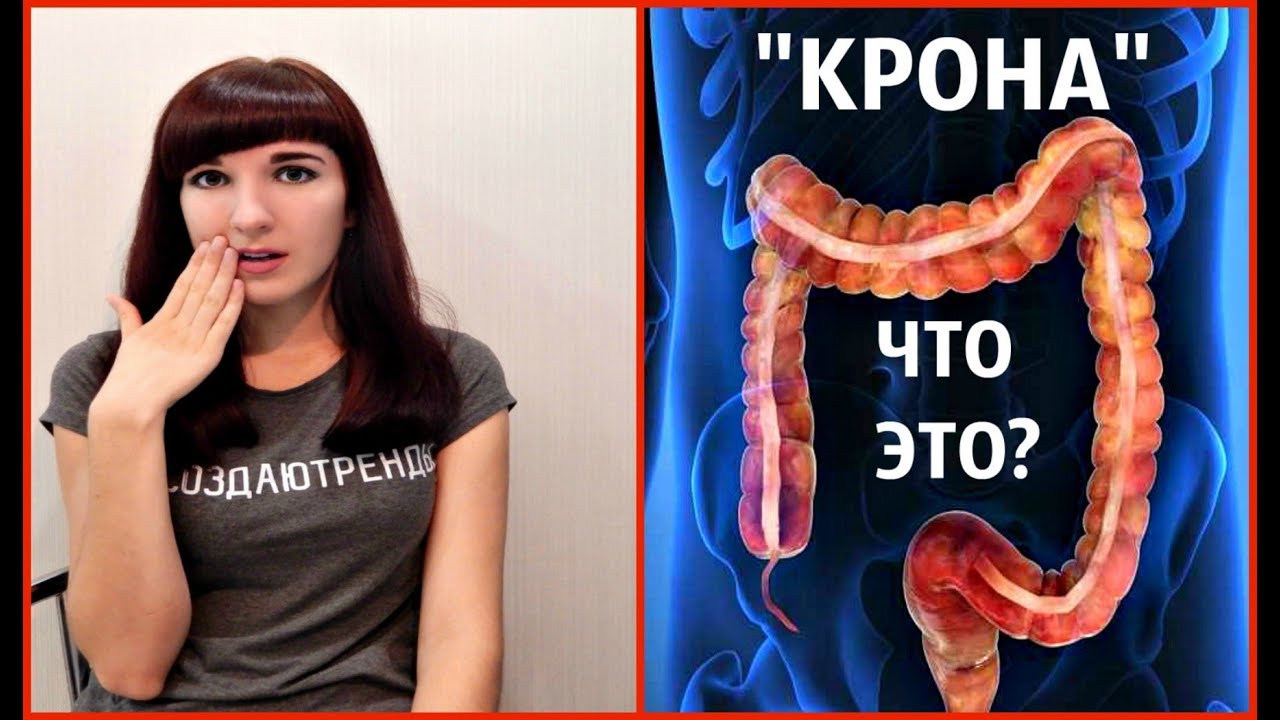 Что Такое Крона Фото Что Такое Крона Фото