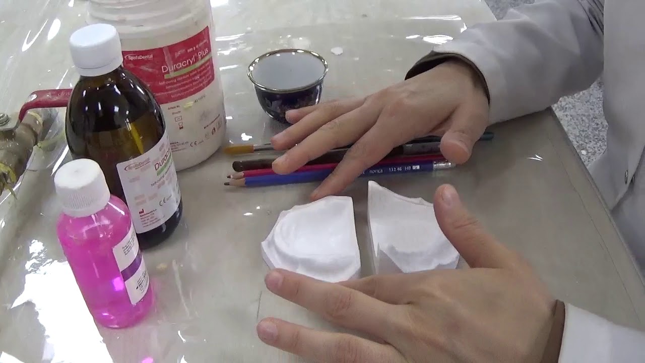 Special tray fabrication 1 YouTube