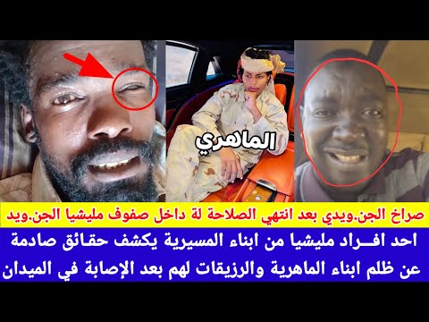 انبشكت جنجويدي من ابناء المسيرية كشف المستور عن قيادات مليشيا من ابناء الماهرية عن جرحي والمصابين