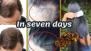 The Indian secret to grow hair at a rocket speed and treat baldness from the first week