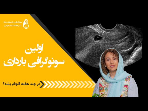 تصویری: آیا بارداری مبهم در سونوگرافی نشان داده می شود؟