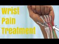 Wrist pain fix in 4 minutes   physiotherapy