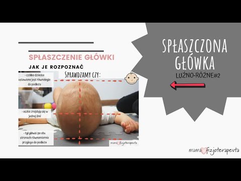 Wideo: Czy zniekształcona głowa sama się poprawi?