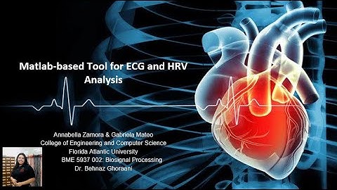 BME 5937 002 Processing Improvements to MATLAB Based Tool for ECG and HRV Analysis