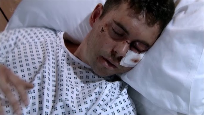 Coronation Street - Todd Sees His Injuries - YouTube