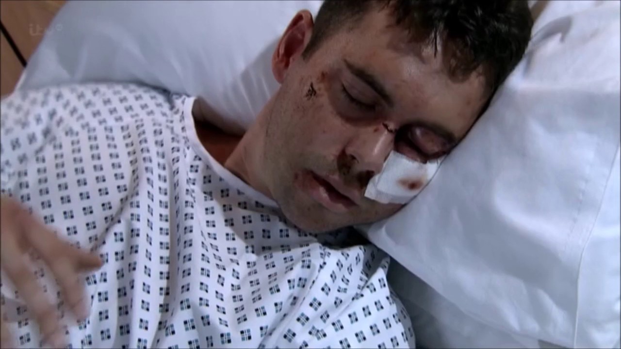 Todd when he was beaten up 10 Nov 2014