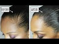 HOW TO: HIDE A BALD SPOT | DISCOCURLSTV