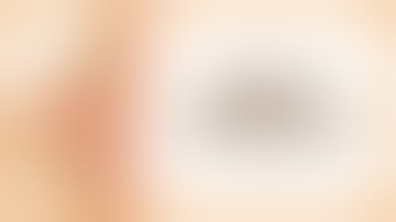 Breast Pathology (Inflammatory vs. Benign vs. Malignant)