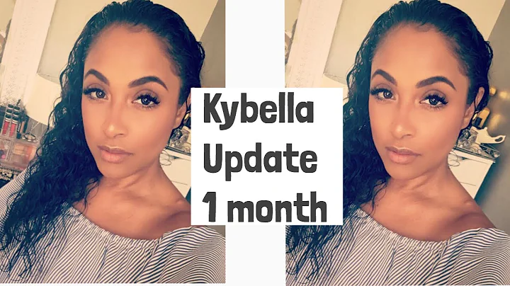 KYBELLA UPDATE 1 MONTH
