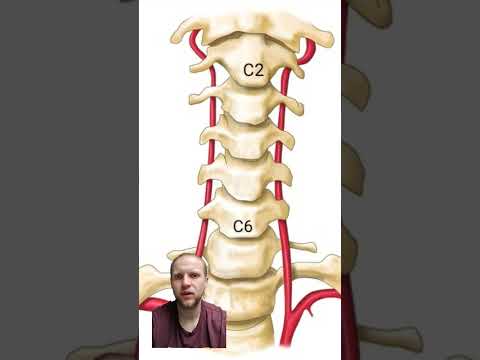 Wideo: Gdzie jest tuberculum caroticum?