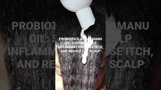 Relief for dry, itchy &amp; flaky scalp! Use code CW15 for 15% off at mysunday2sunday.com