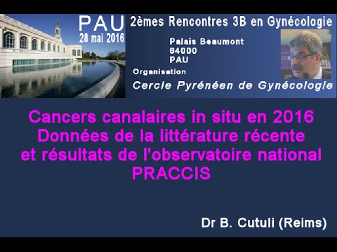 Vidéo: Le Diagnostic Et La Prise En Charge De La Maladie Mammaire Pré-invasive: Carcinome Canalaire In Situ (CCIS) Et Hyperplasie Canalaire Atypique (ADH) - Définitions Et Classification