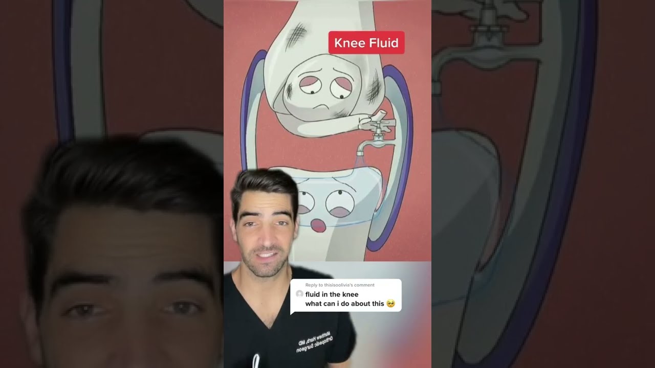 Fluid In The Knee