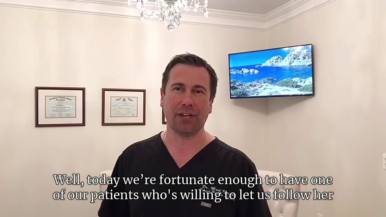 🦋 Dr Mark Karolak ‘s Facelift and Neck Lift 🦋 YouTube
