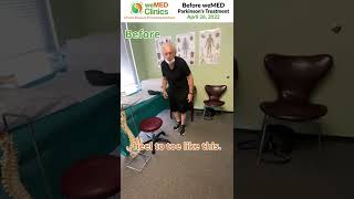 Case Study Parkinsons Disease - Before & After