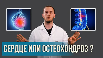 Боль в грудной клетке: СЕРДЦЕ или ОСТЕОХОНДРОЗ? | Раскладываем все по полочкам | Доктор Епифанов