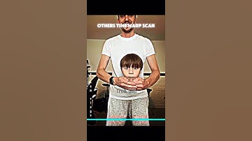 Others Time Warp Scan VS this Girl ☠️ #trollface #skulledit #shorts #timewarpscan #troll