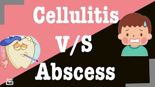 Difference between Cellulitis and Abscess I Cellulitis v/s Abscess screenshot 5