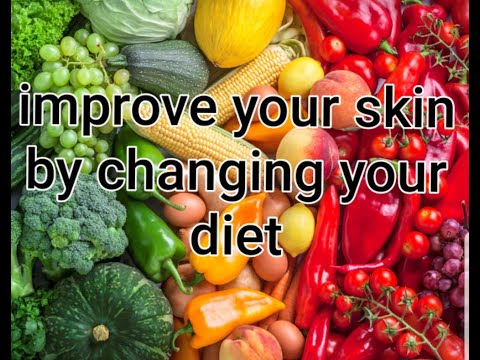 Acne diet guide