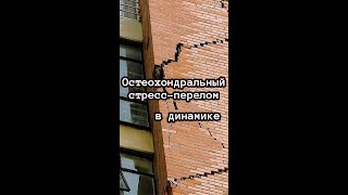 стресс-перелом в динамике