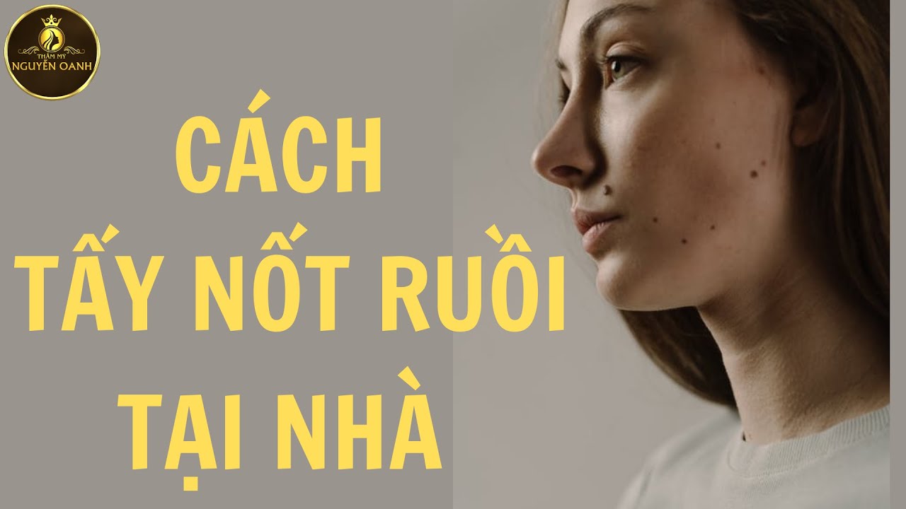 tẩy nốt ruồi an toàn New Cách tẩy nốt ruồi đơn giản, dễ làm tại nhà