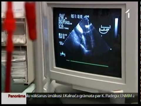Video: Kad tika atklāta sirds miksoma?