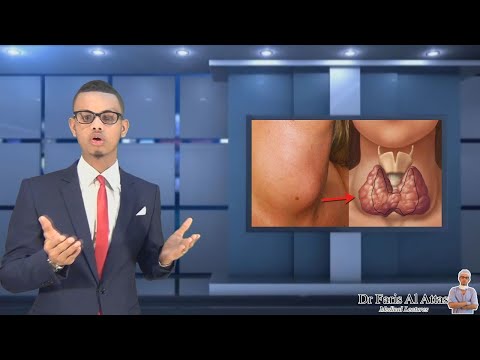 CUDURADA KU DHACA QANJIRKA DHUUNTA EE THYROID-KA.  Dr faris