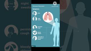#Tuberculosis Mycobacterium tuberculosis#symptoms #disease #youtubeshorts #shortvideo