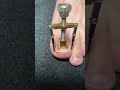 Doctor-Style Ingrown Toenail CorrectionPerfect Nail Alignment
