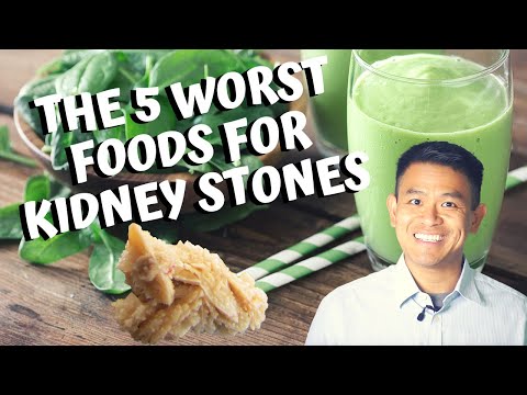 कैल्शियम ऑक्सालेट किडनी स्टोन्स के लिए 5 सबसे खराब खाद्य पदार्थ | किडनी स्टोन होने से कैसे रोकें (2020)