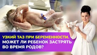 🤰🏻Узкий Таз При Беременности. Может Ли Ребенок Застрять Во Время Родов?